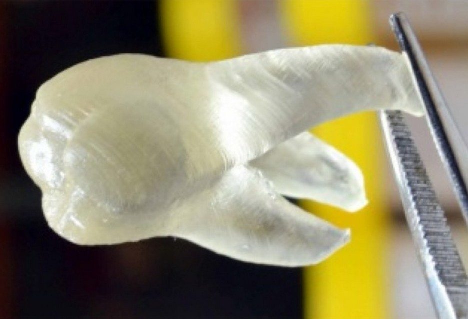 Зубы с 3D-принтера убивают кариес