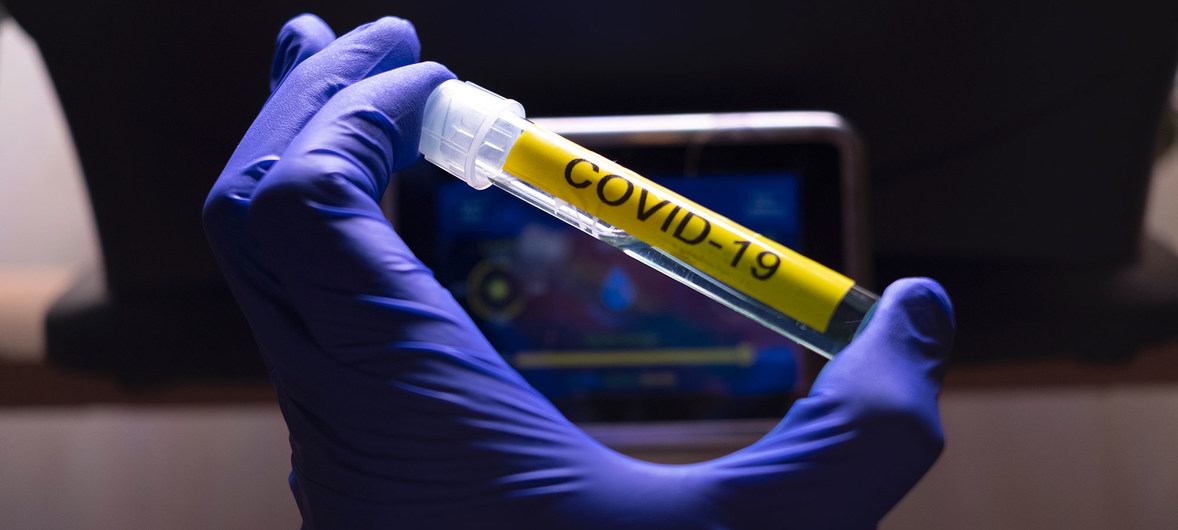 Украинцы смогут самостоятельно покупать вакцину против COVID-19 не ранее лета-осени