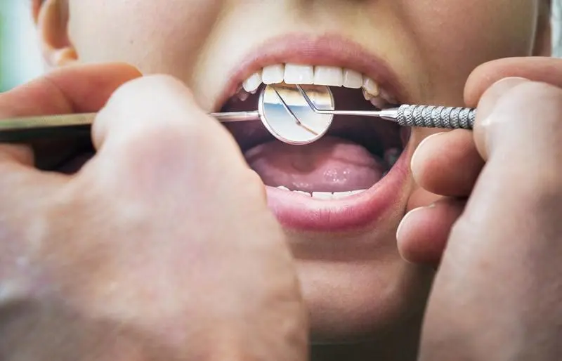 Травильные гели в стоматологической практике
